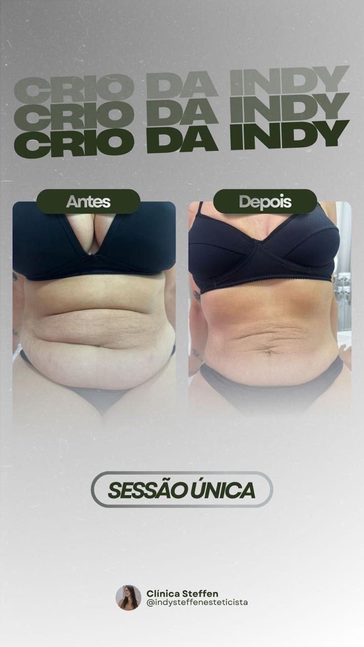 Método Crio da Indi - Caso 4